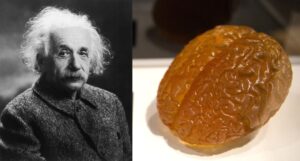 Where is Einstein's brain?