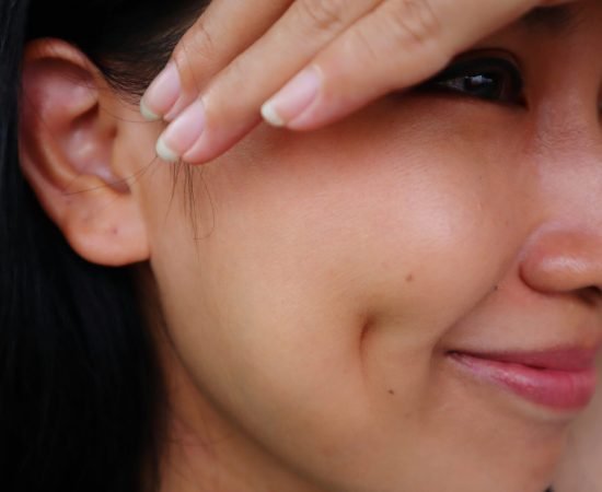 What causes dimples?