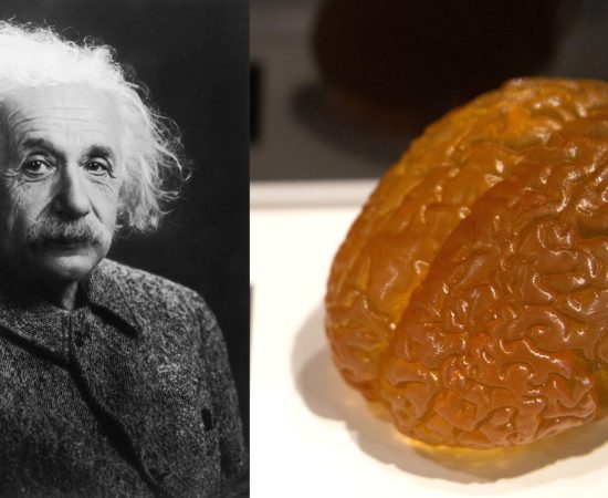 Where is Einstein's brain?